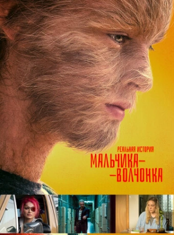 Реальная история мальчика-волчонка
